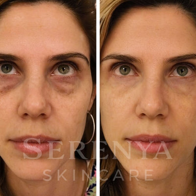 All-in-One Eye Repair Serum