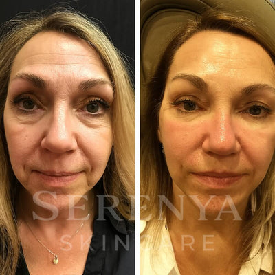 All-in-One Eye Repair Serum