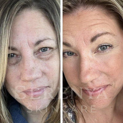 All-in-One Eye Repair Serum