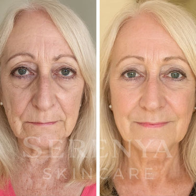 All-in-One Eye Repair Serum